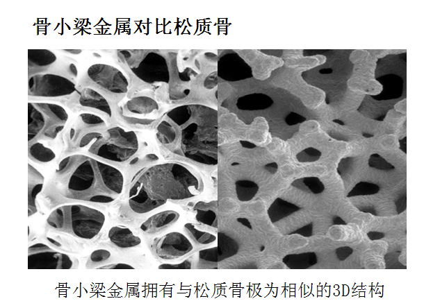 骨小梁金属产品-关节trabecular metal