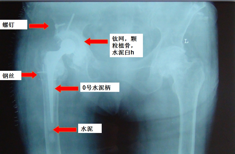 骨科在线手机版