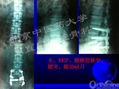 幻灯片22.jpg
