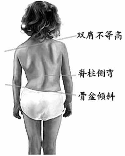 11b001.gif