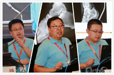说明:E:\事业发展部上会记录\2017.8.12杭州施乐辉创伤大师会\8.12稿件用图\第四节发言.jpg