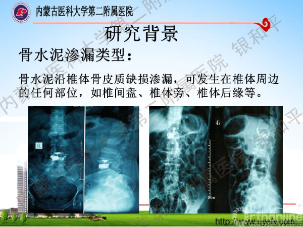 幻灯片6.png