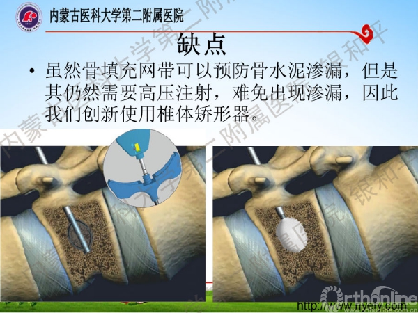 幻灯片14.png
