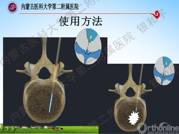 幻灯片25.png