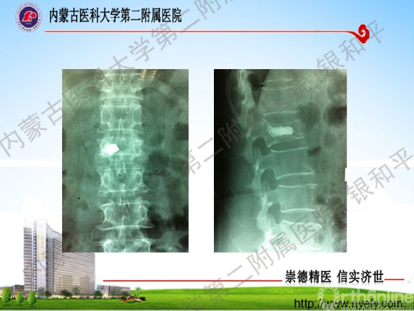 幻灯片35.png