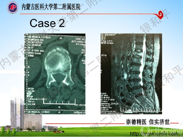 幻灯片36.png