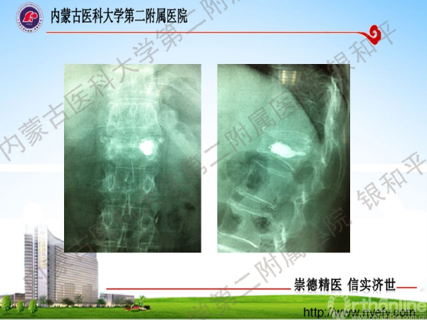 幻灯片39.png