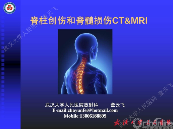 查云飞：脊柱创伤和脊髓损伤CT&MRI（上） | 骨科在线手机版