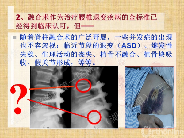 幻灯片3.png