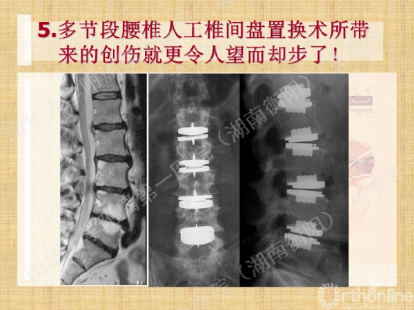 幻灯片11.png