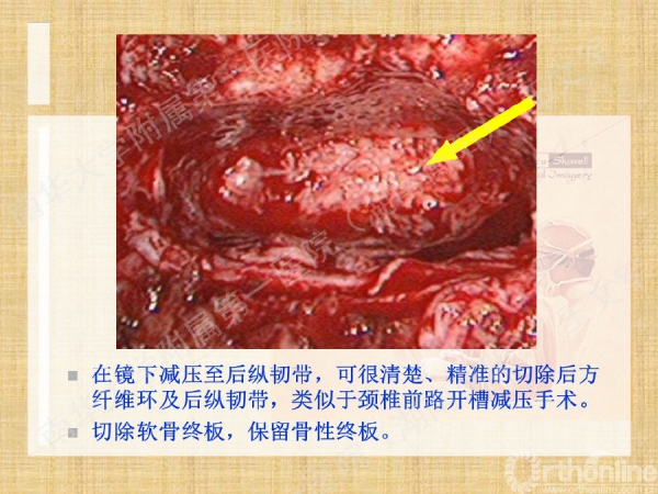 幻灯片35.png