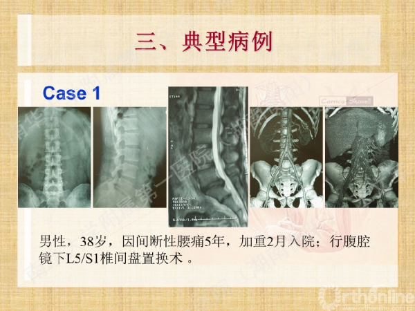 幻灯片39.png