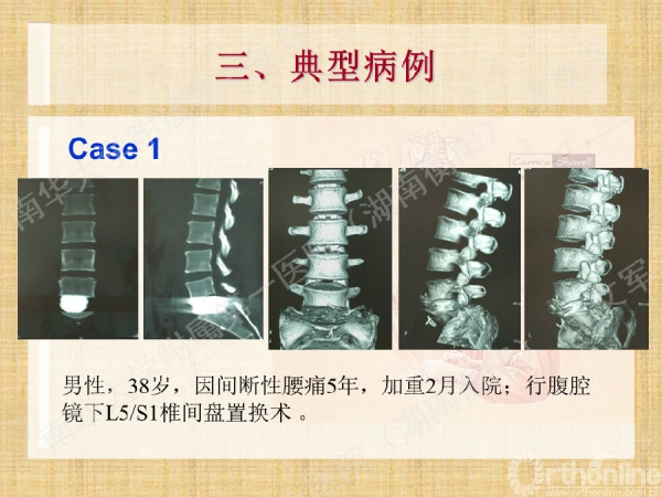幻灯片41.png