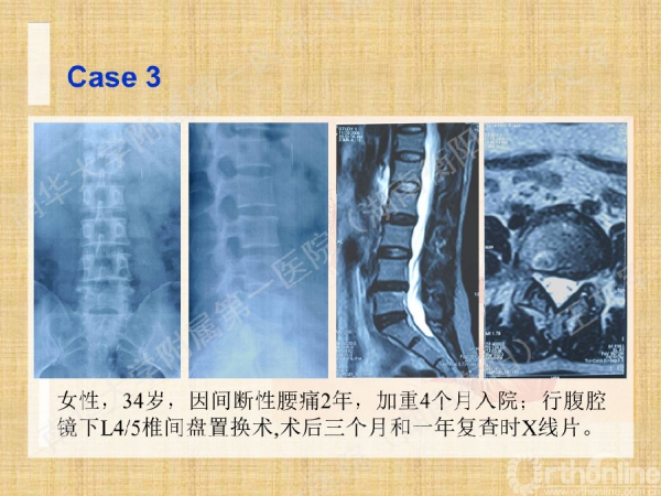 幻灯片45.png