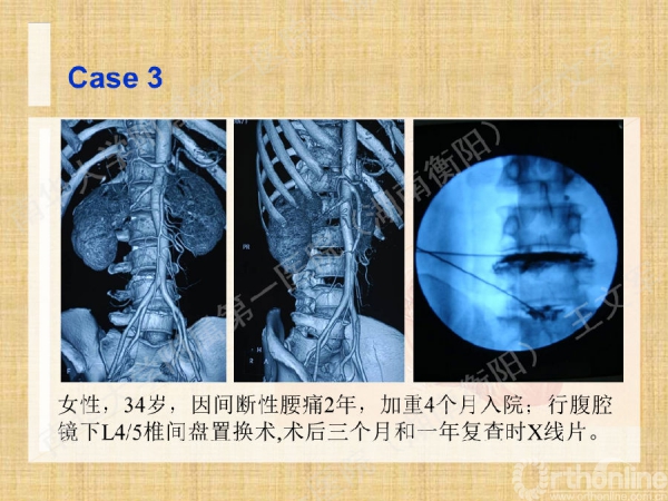 幻灯片46.png