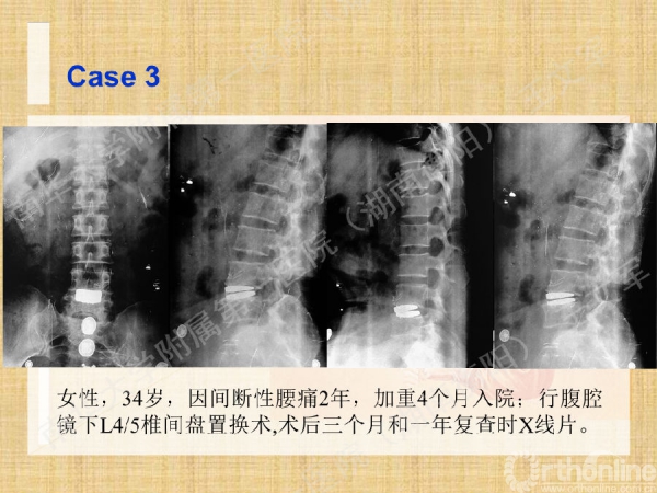 幻灯片49.png