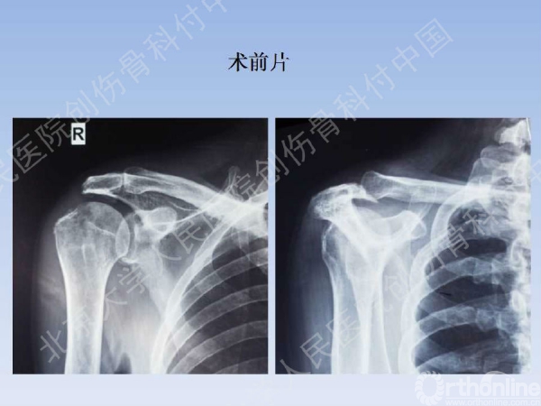 幻灯片2.jpg