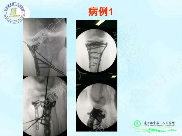 幻灯片77.jpg
