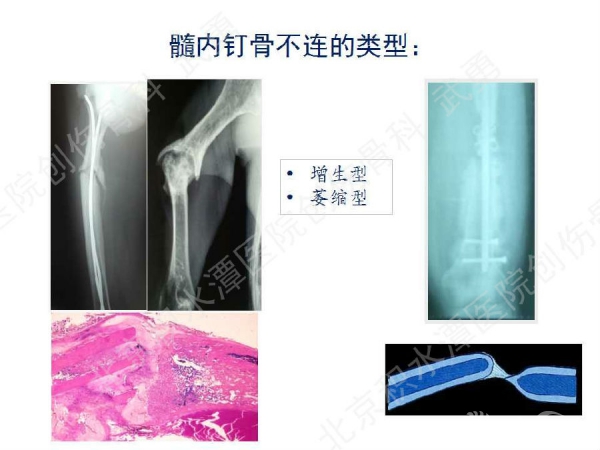 幻灯片9.jpg