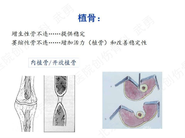 幻灯片24.jpg