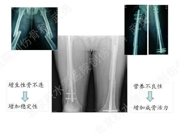 幻灯片25.jpg