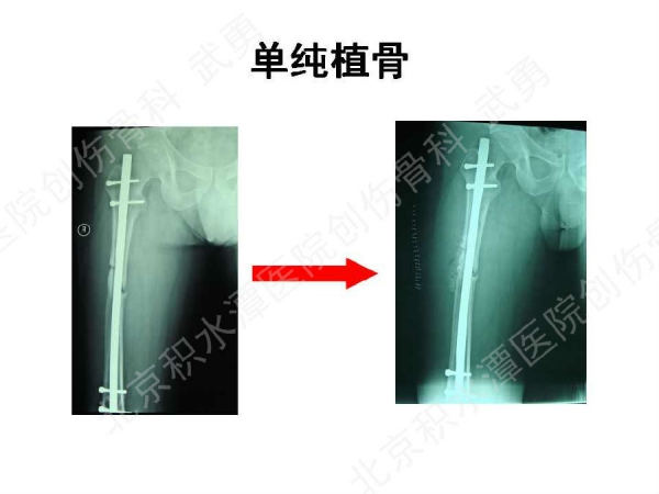幻灯片36.jpg