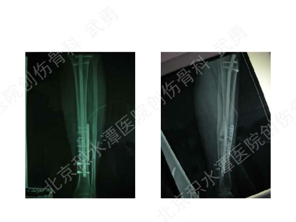 幻灯片46.jpg