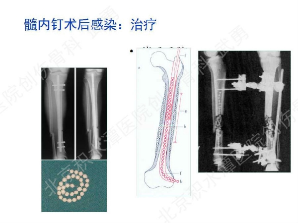 幻灯片57.jpg