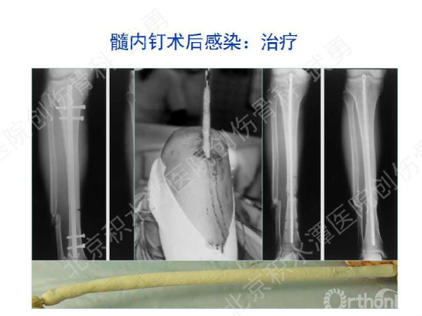 幻灯片60.jpg