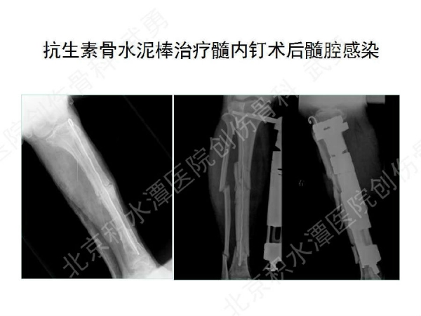 幻灯片61.jpg