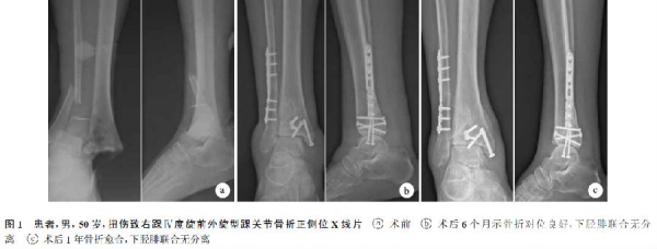QQ图片20160810132446.png