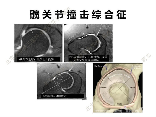 幻灯片3(1).JPG