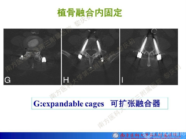 幻灯片12.JPG