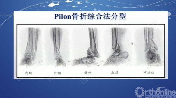 幻灯片11.JPG