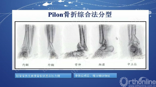 幻灯片41.JPG