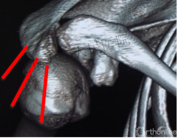 19.png