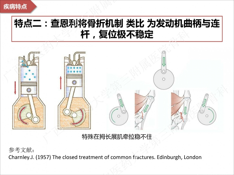 辅助中国笼牵引指套经皮1238jpg_Page7.jpg