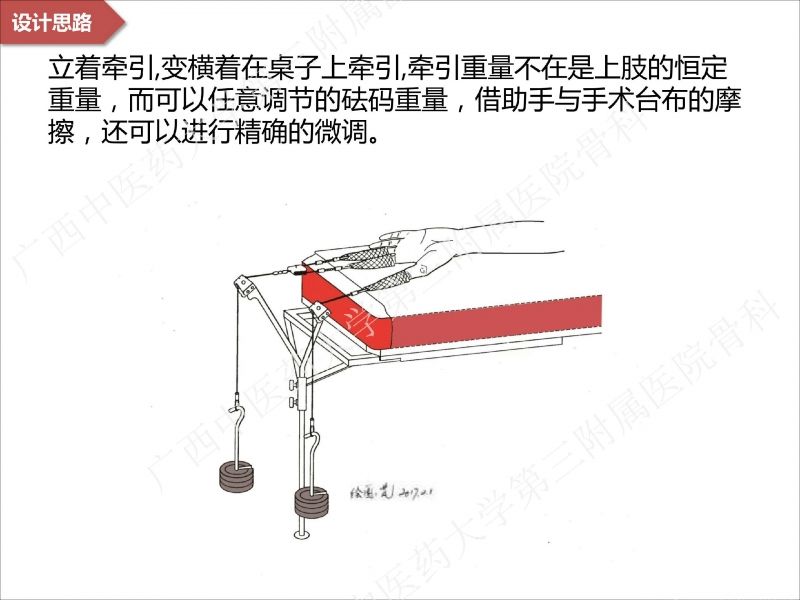 辅助中国笼牵引指套经皮1238jpg_Page16.jpg