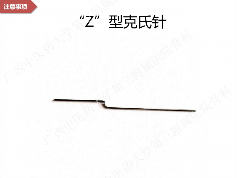 辅助中国笼牵引指套经皮1238jpg_Page25.jpg