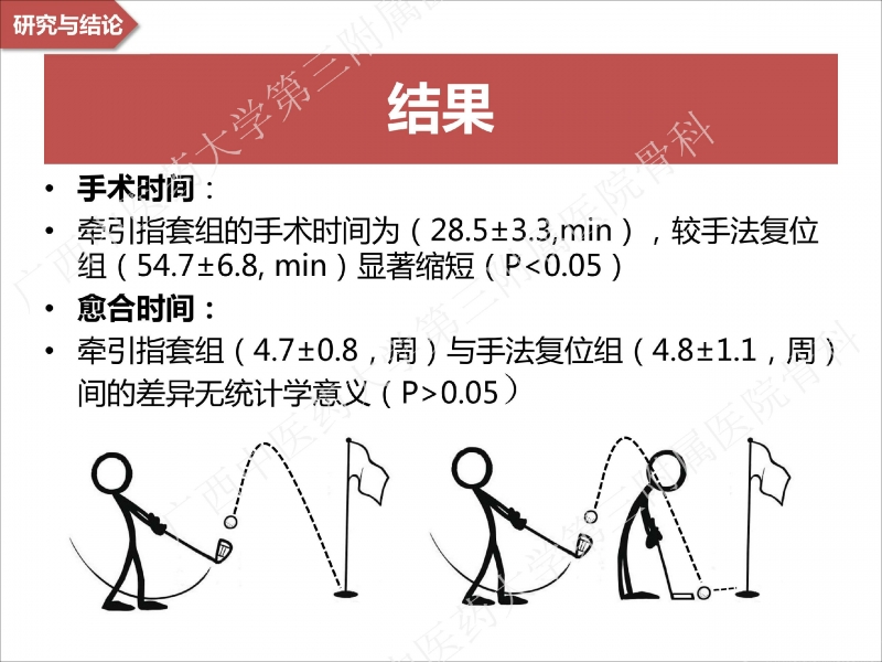 辅助中国笼牵引指套经皮1238jpg_Page28.jpg