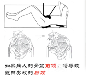 QQ图片20141128151452.png