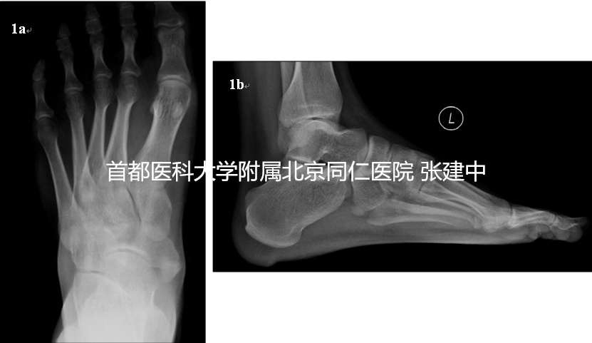 图1_副本.png