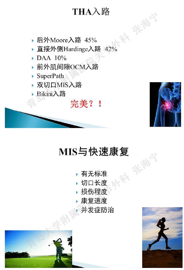 比基尼入路微创人工全髋关节置换术_页面_02.png