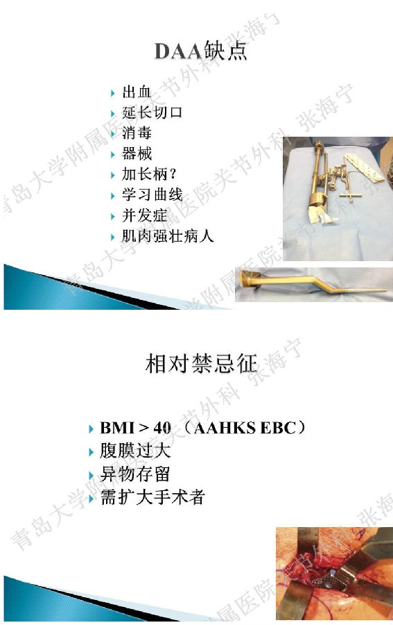 比基尼入路微创人工全髋关节置换术_页面_05.png