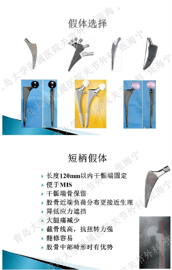 比基尼入路微创人工全髋关节置换术_页面_12.png
