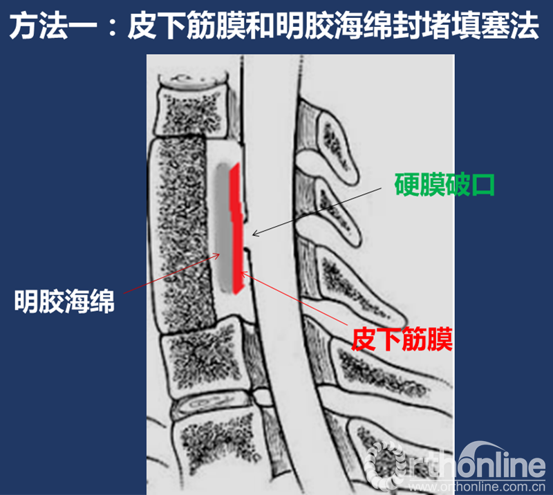 幻灯片17.PNG