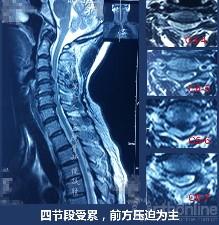 幻灯片33.PNG