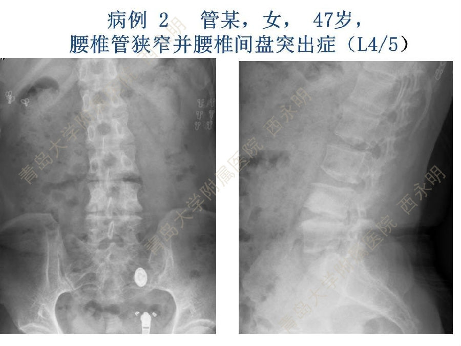 幻灯片15.JPG