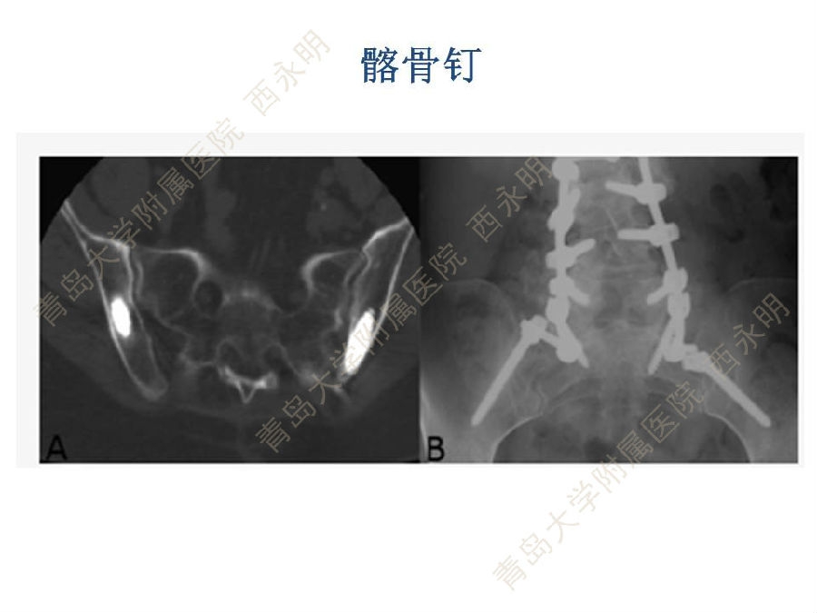 幻灯片39.JPG
