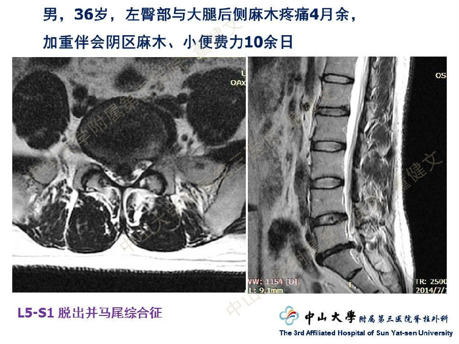 幻灯片22.JPG